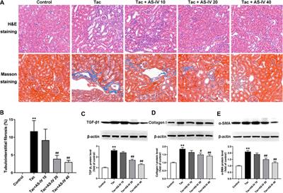 Astragaloside IV Alleviates Tacrolimus-Induced Chronic Nephrotoxicity via p62-Keap1-Nrf2 Pathway